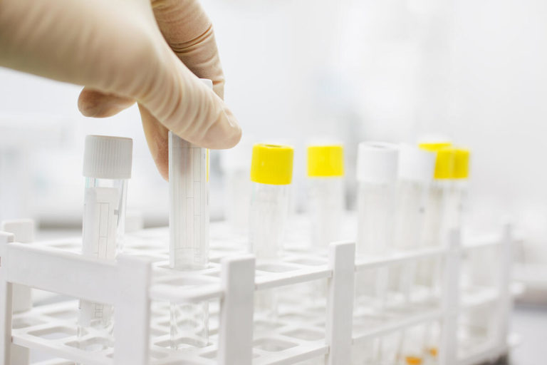 What Is Hair Follicle Drug Testing? How Can It Support Your Hiring