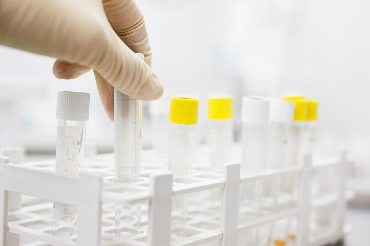 What Is Hair Follicle Drug Testing? How Can It Support Your Hiring